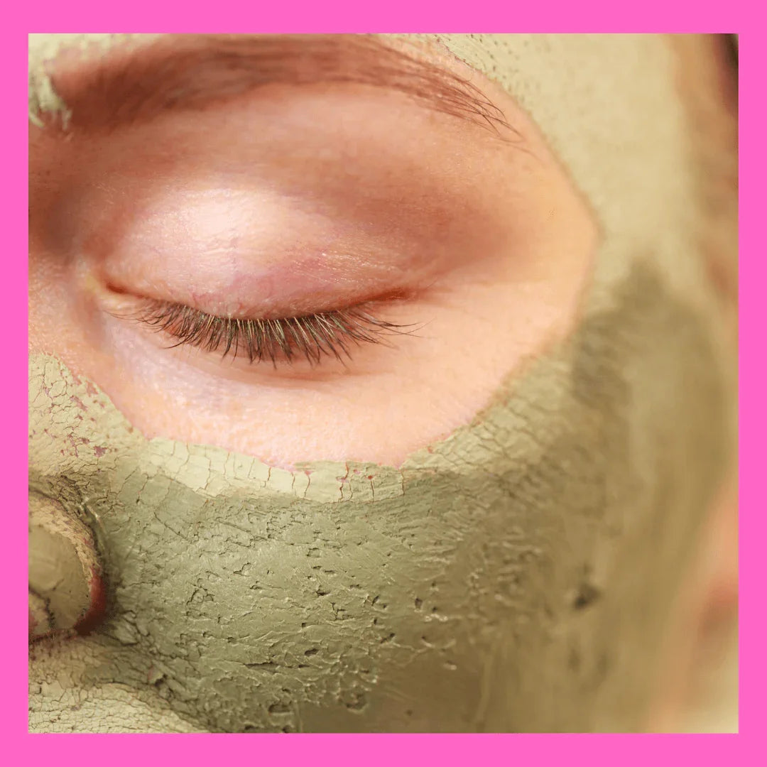 GREEN PEEL - ACID EXFOLIATION - RESURFACING ( 3 DAYS RECOVERING TIME ) approx  ( with combination of skin needling )