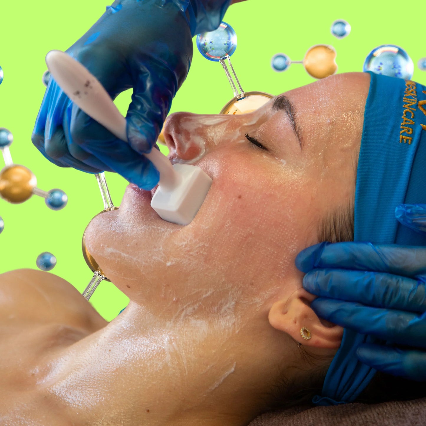 FACIAL SKIN NEEDLING ( with combination of PEELS )