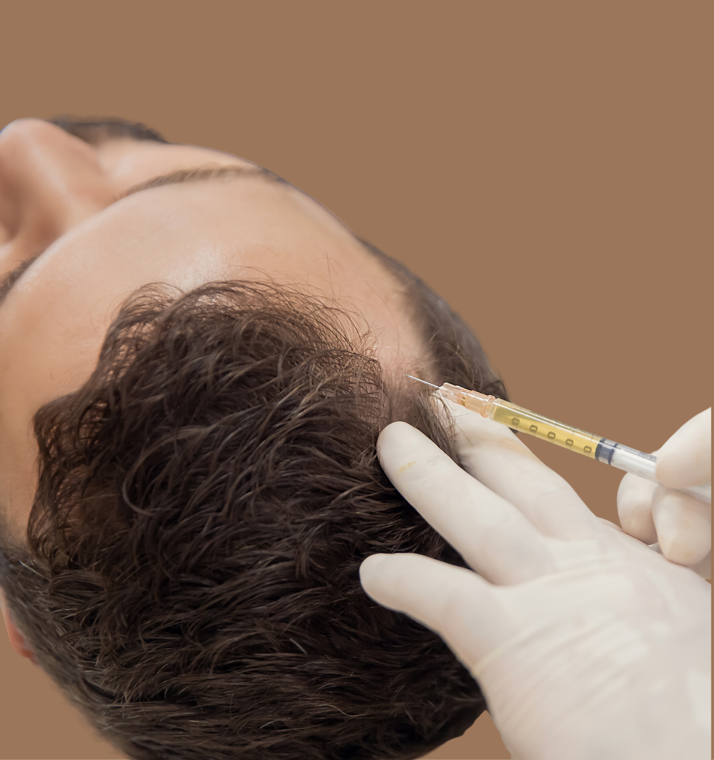 PRP Facelift + Fillers