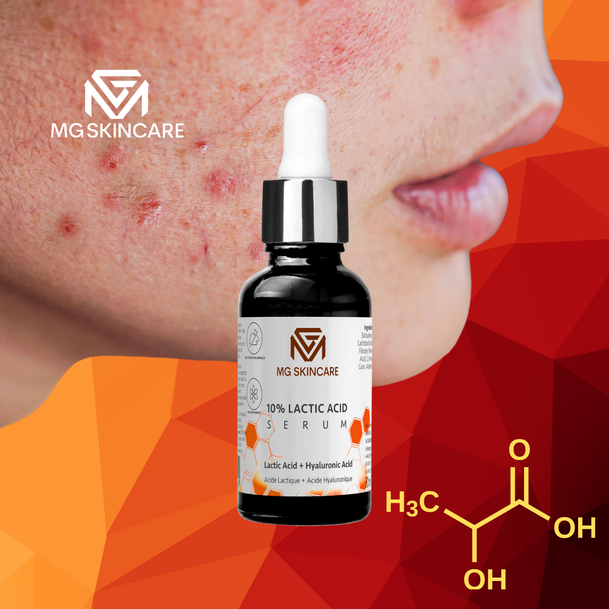 LACTIC ACID SERUM