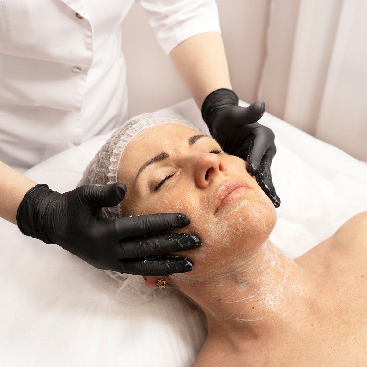 Chemical-Peel - MG Skincare