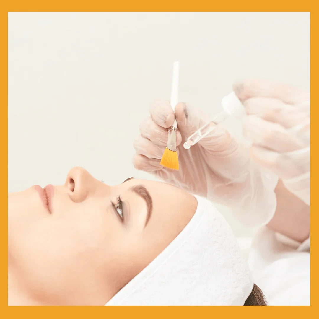 GREEN PEEL - ACID EXFOLIATION - RESURFACING ( 3 DAYS RECOVERING TIME ) approx  ( with combination of skin needling )