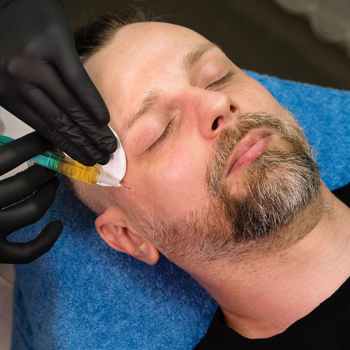 PRP Facelift + Fillers - MG Skincare