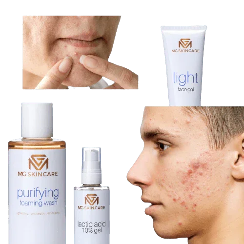 PURIFYING FACE TONER - MG Skincare