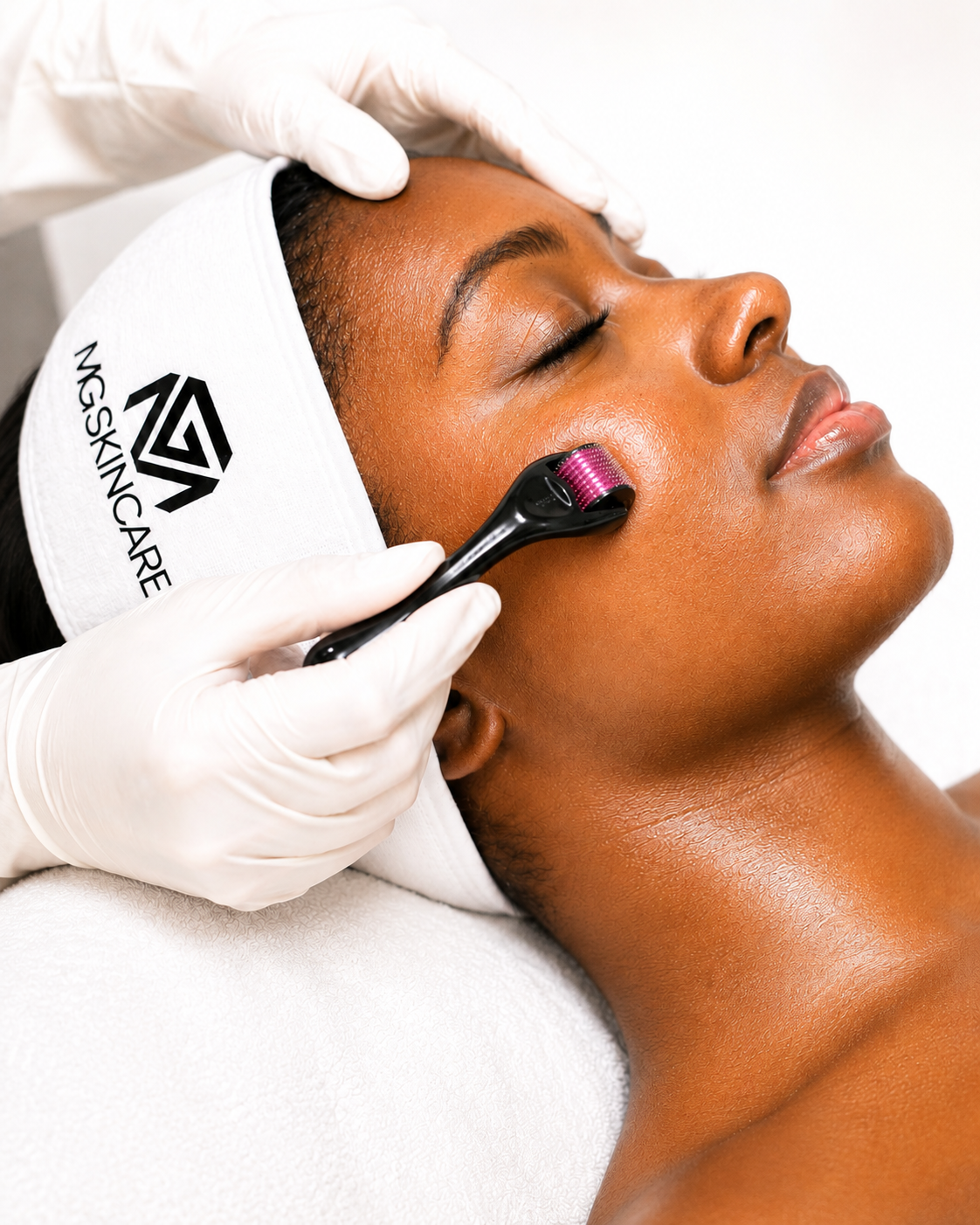 ADVANCED SKIN NEEDLING + EXOSOMES