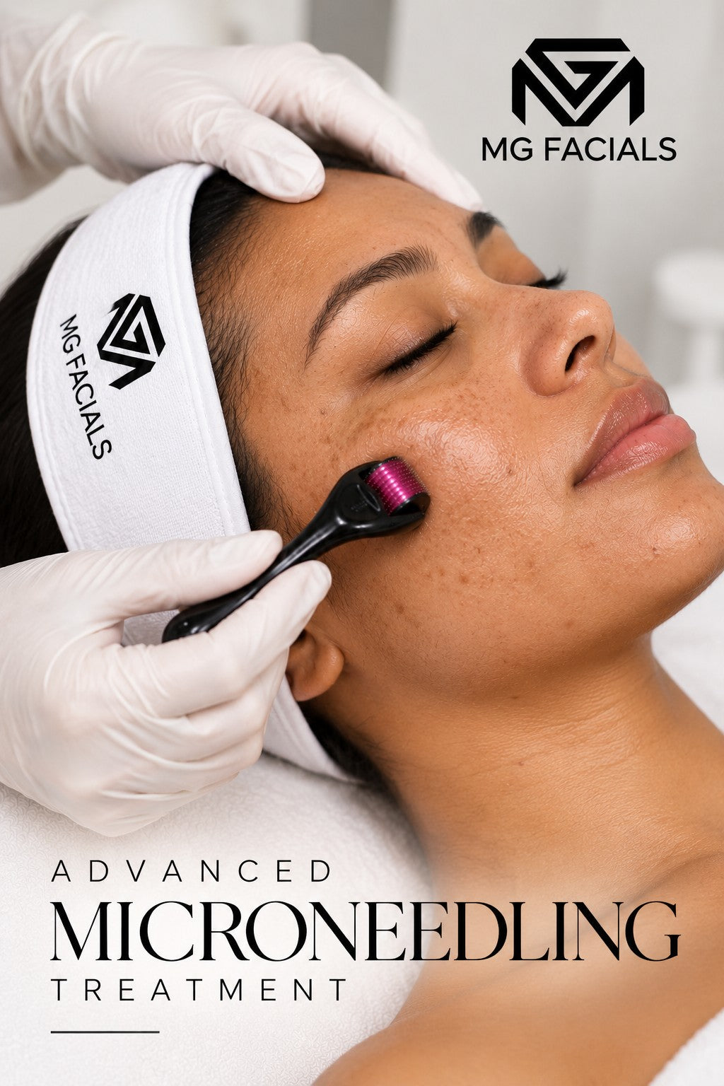 ADVANCED MG SIGNATURE FACIALS AGING/PIGMENTATION. ( SKIN NEEDLING & PEELS + MACHINERY )