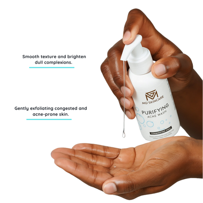PURIFYNG  ACNE WASH