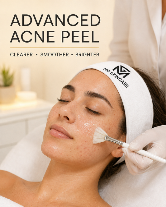 ADVANCED ACNE FACIAL ADVANCED - WITH PEELS & SKIN NEEDLING LONDON SE1