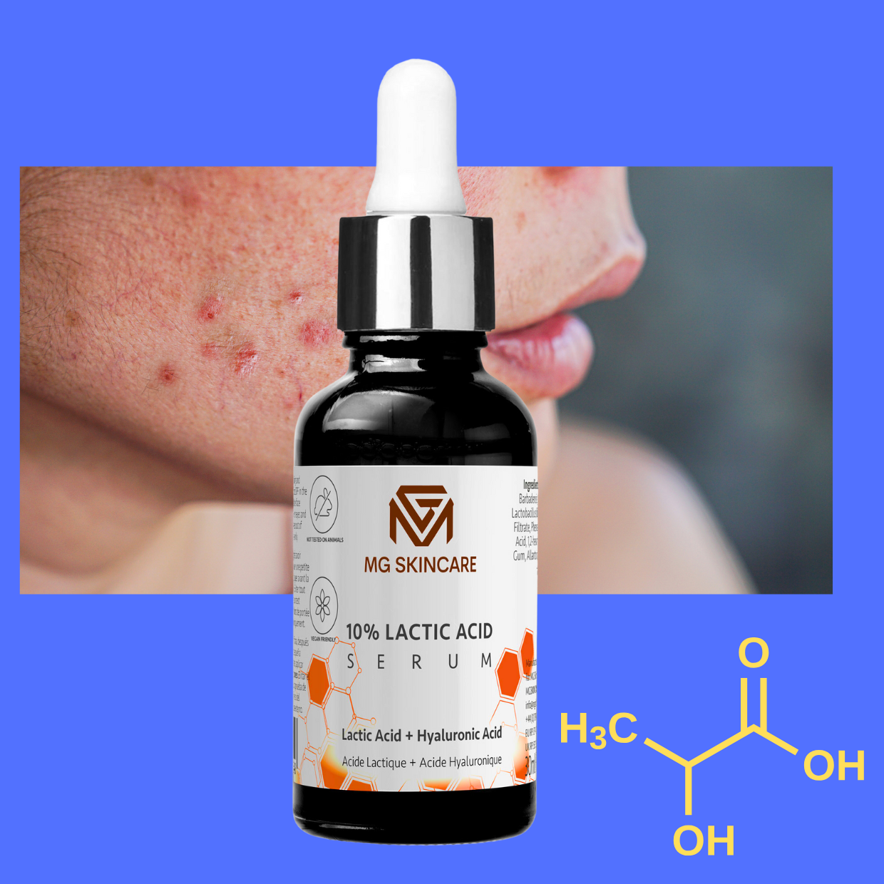 LACTIC ACID SERUM