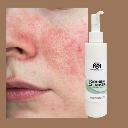 SOOTHING MILKY CLEANSER - FACE & EYES MAKEUP REMOVAL/CLEANSER