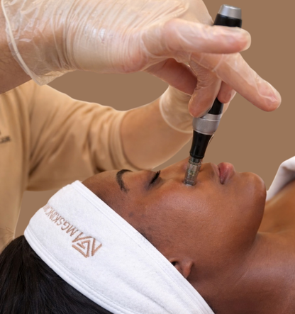 SKIN NEEDLING ADVANCED 30min