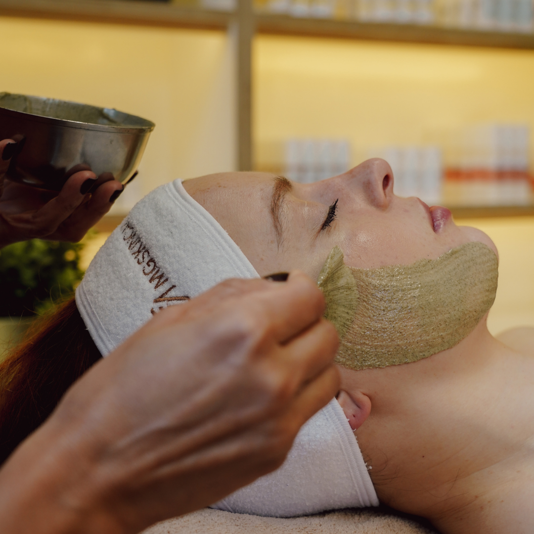 GREEN PEEL - ACID EXFOLIATION - RESURFACING ( 3 DAYS RECOVERING TIME ) approx  ( with combination of skin needling )