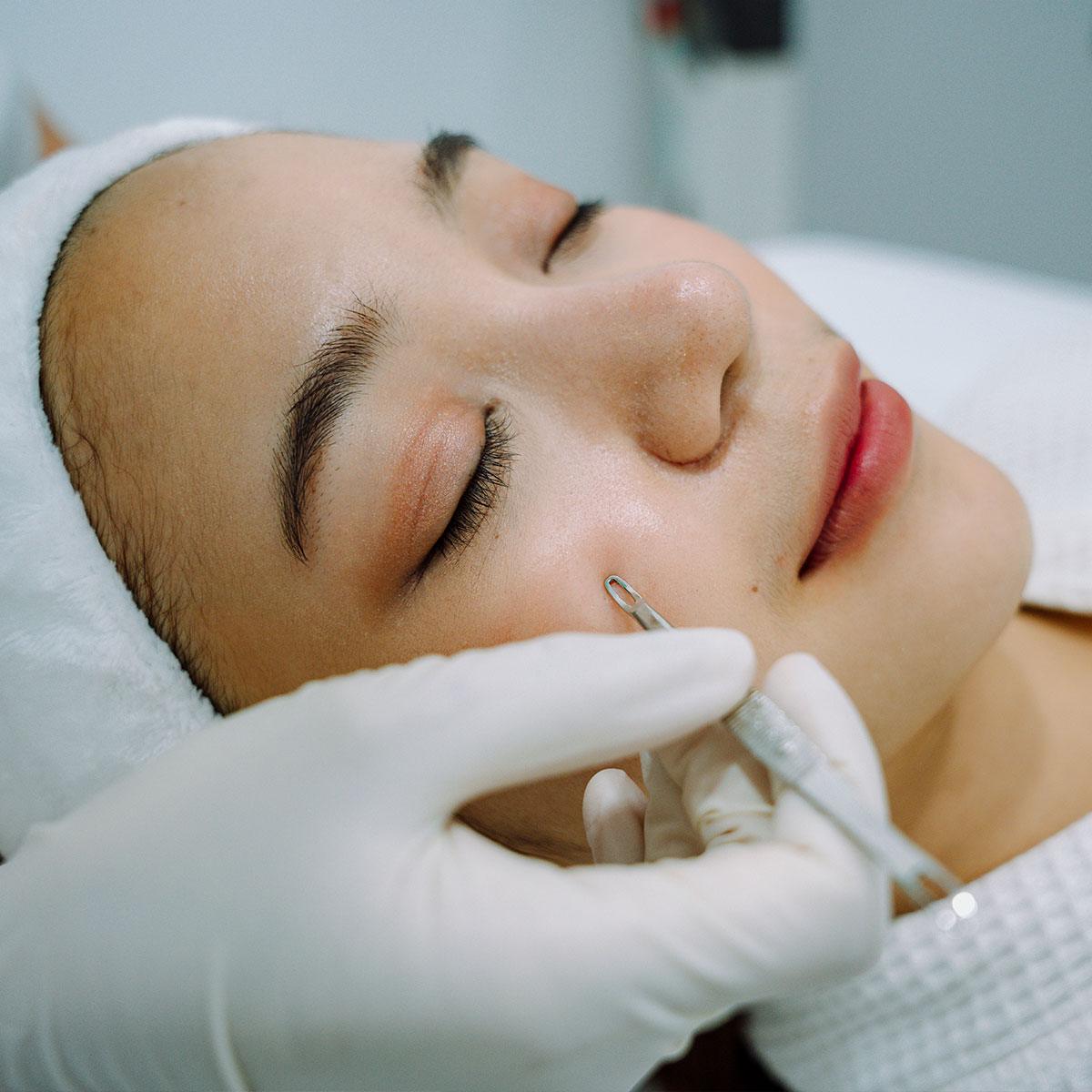 Facial - Acne + Congestion - MG Skincare