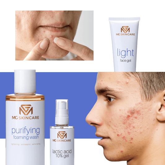 OILY - ACNE - CARE AT HOME - MG Skincare