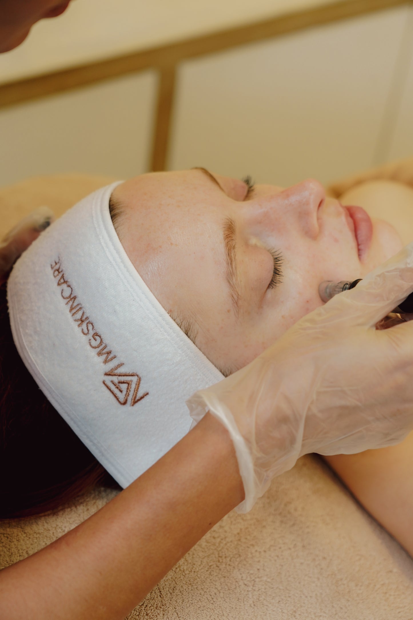 ADVANCED SKIN NEEDLING WITH PEELS. TREATING PIGMENTATION, ACNE, ACNE SCARS & AGEING SKIN.