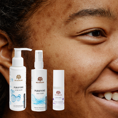 ACNE SKIN SET