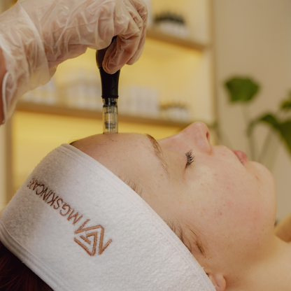 ADVANCED SKIN NEEDLING WITH PEELS. TREATING PIGMENTATION, ACNE, ACNE SCARS & AGEING SKIN.