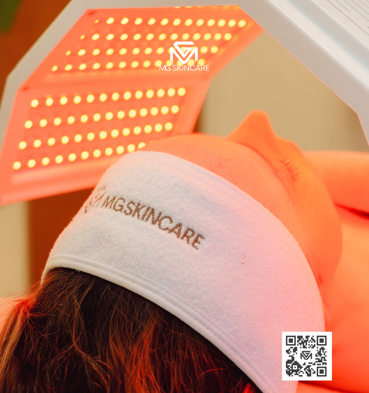 ADVANCED ACNE FACIAL ADVANCED - WITH PEELS & SKIN NEEDLING LONDON SE1