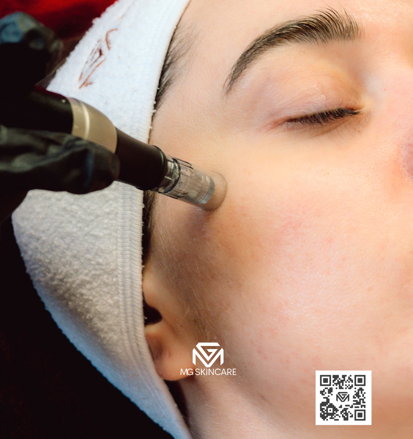 ANTI AGING FACIALS USING RADIO FREQUENCY & OTHER FACE MACHINES.