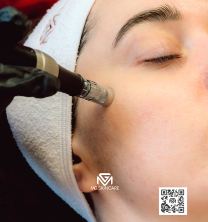 ANTI AGING FACIALS USING RADIO FREQUENCY & OTHER FACE MACHINES.
