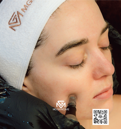 SKIN NEEDLING ADVANCED 30min