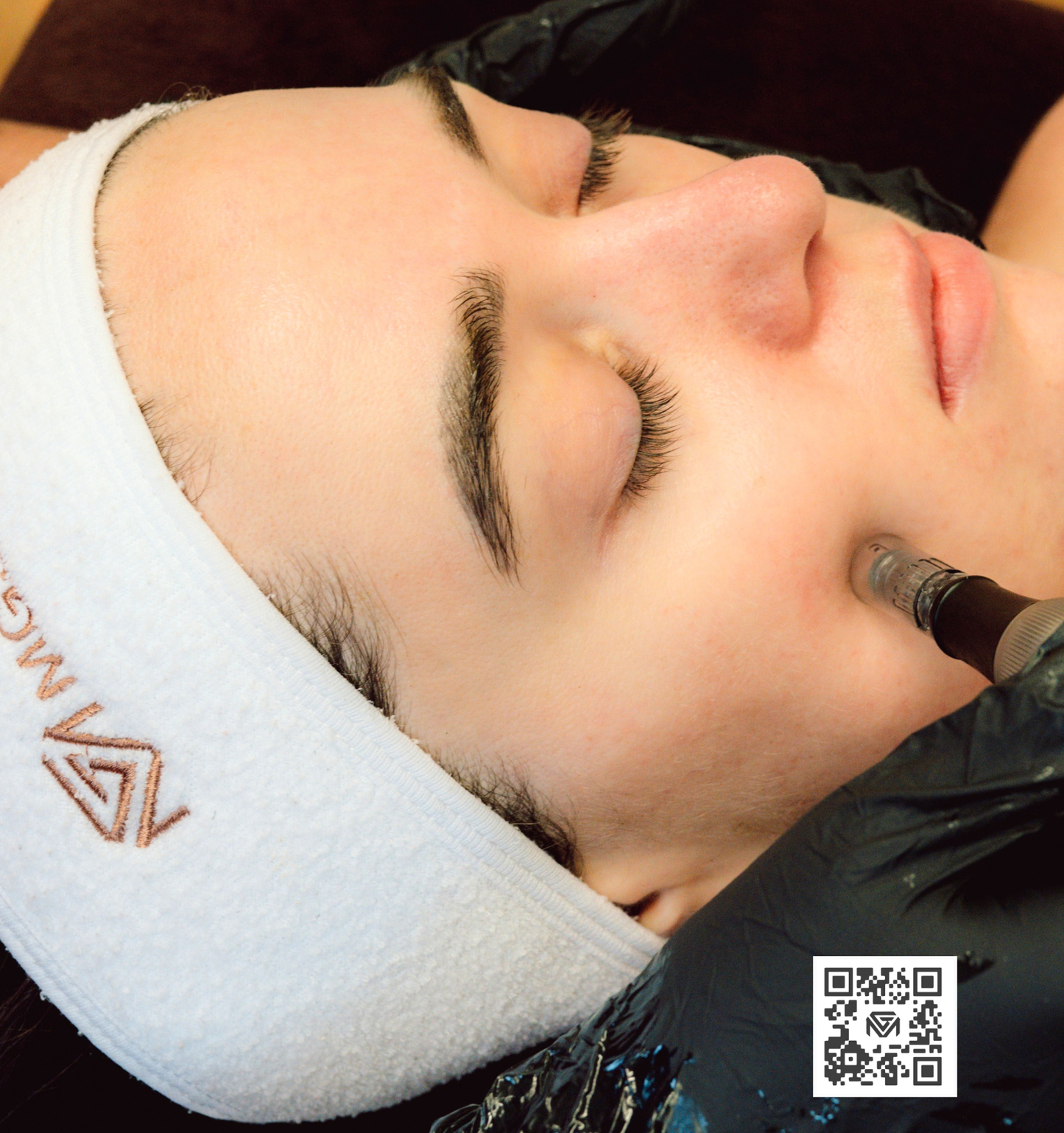 SKIN NEEDLING ADVANCED 30min