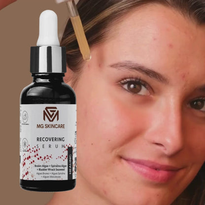 RECOVERING OIL SERUM