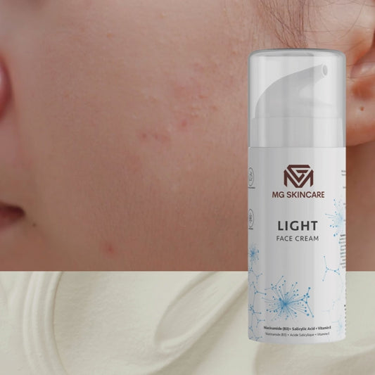 LIGHT FACE CREAM