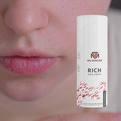 RICH FACE CREAM TREATING AGING.DAMAGED & ROSACEA.