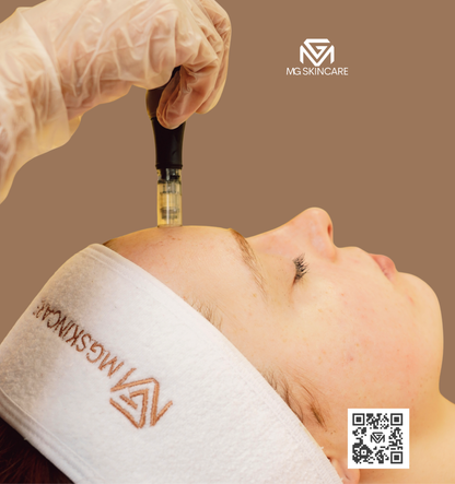 SKIN NEEDLING ADVANCED 30min
