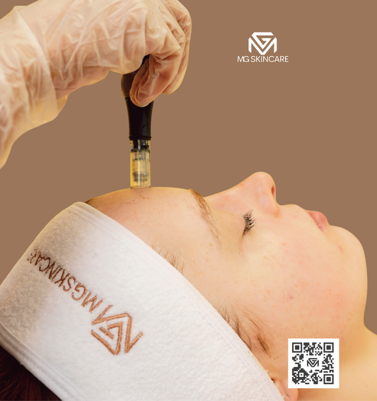 SKIN NEEDLING ADVANCED 30min